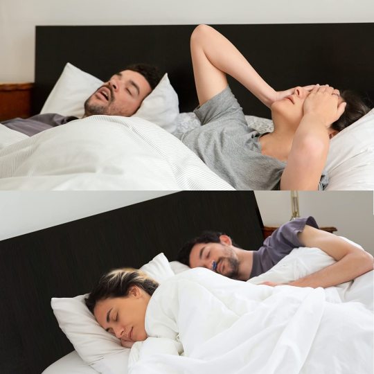 NasalEase™ - Comfortabel anti-snurkapparaat