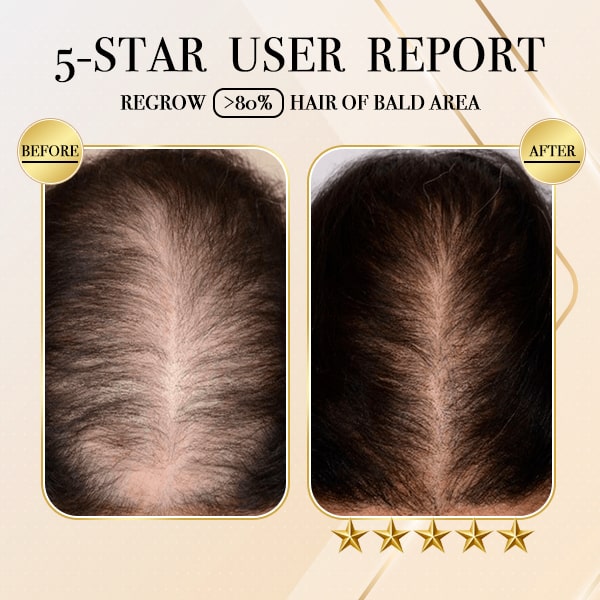 ReGrow™ Ginger Hair Growth Shampoo Bar (1+1 Gratis)