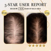 Afbeelding laden in Galerijviewer, ReGrow™ Ginger Hair Growth Shampoo Bar (1+1 Gratis)